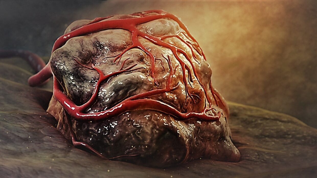 Kuva: Wikimedia Commons